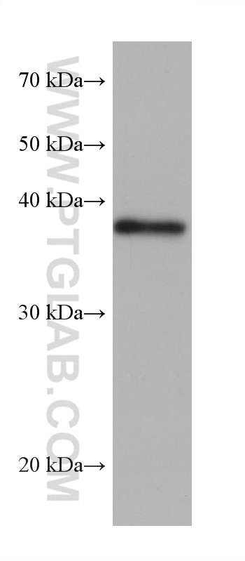 Western Blot (WB) analysis of LNCaP cells using ZC3H8 Monoclonal antibody (68282-1-Ig)