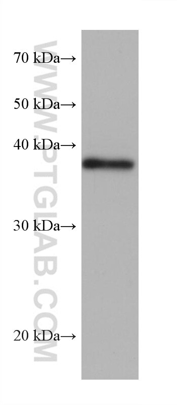 Western Blot (WB) analysis of LNCaP cells using ZC3H8 Monoclonal antibody (68282-1-Ig)