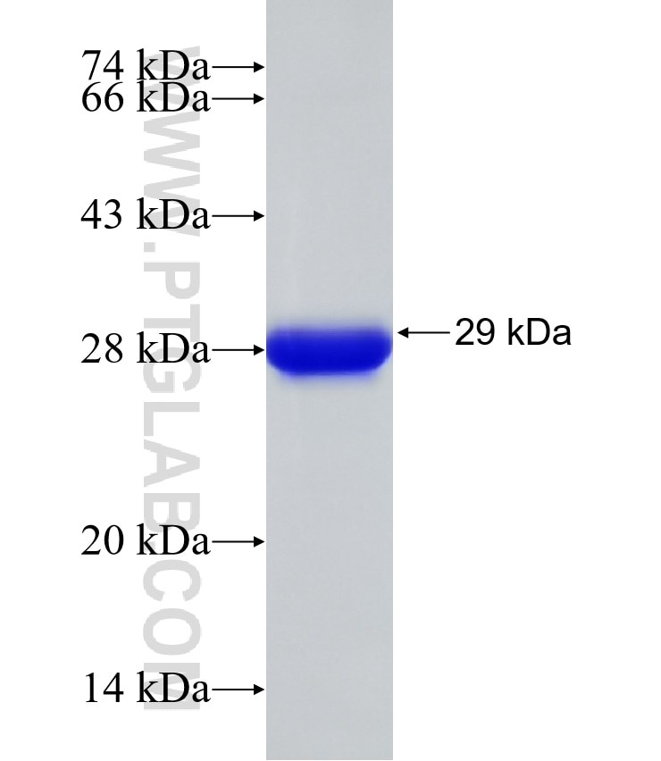 ZC3H8 fusion protein Ag23496 SDS-PAGE