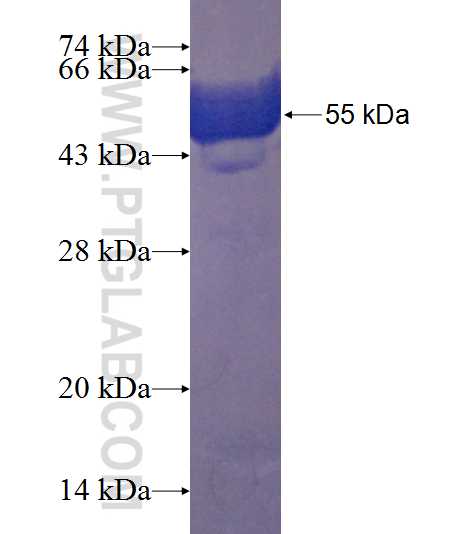ZC3H8 fusion protein Ag23514 SDS-PAGE