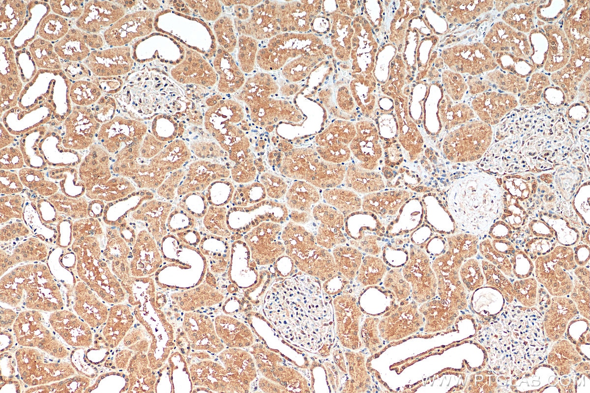 Immunohistochemistry (IHC) staining of human kidney tissue using ZC3HAV1 Polyclonal antibody (16820-1-AP)