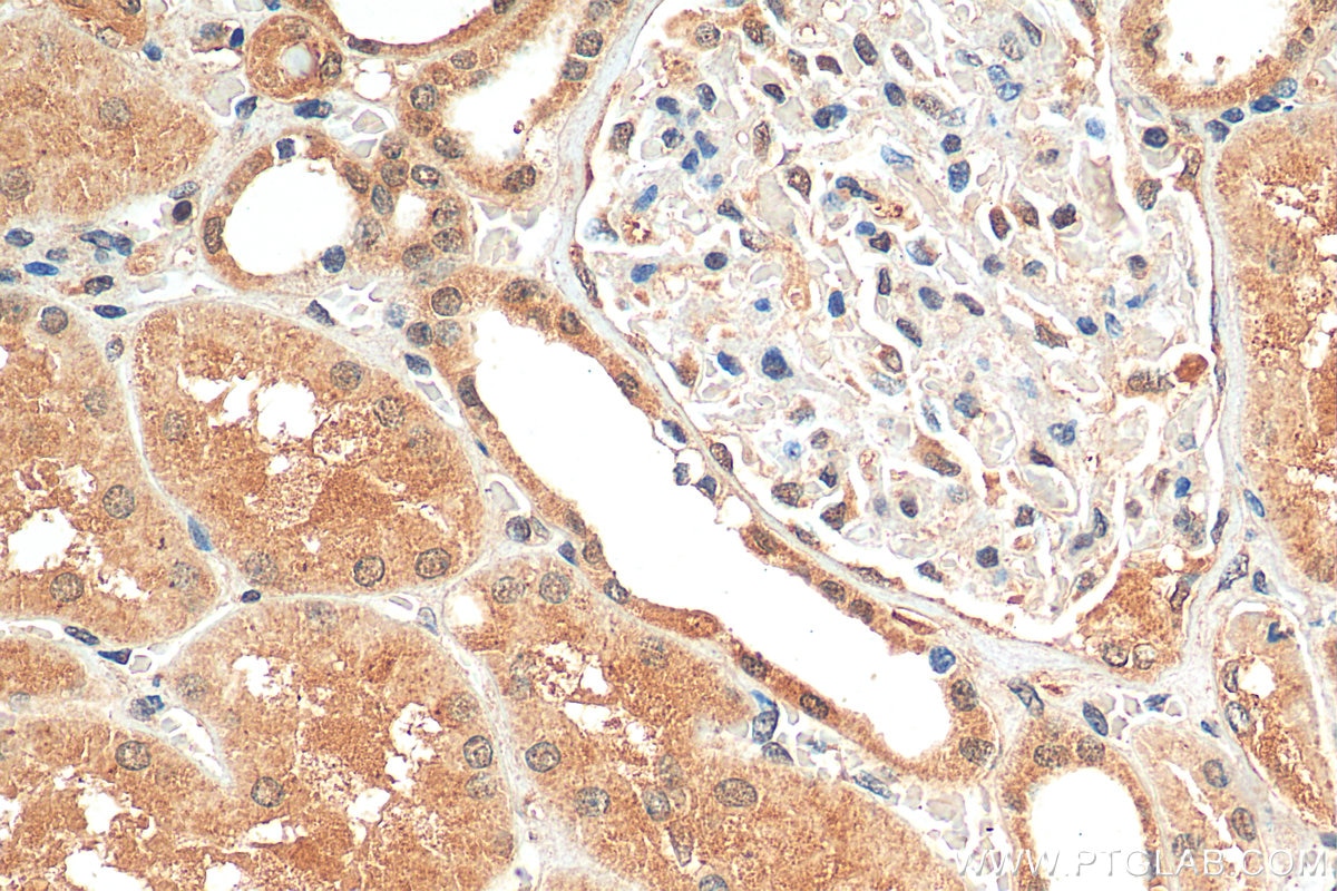 Immunohistochemistry (IHC) staining of human kidney tissue using ZC3HAV1 Polyclonal antibody (16820-1-AP)