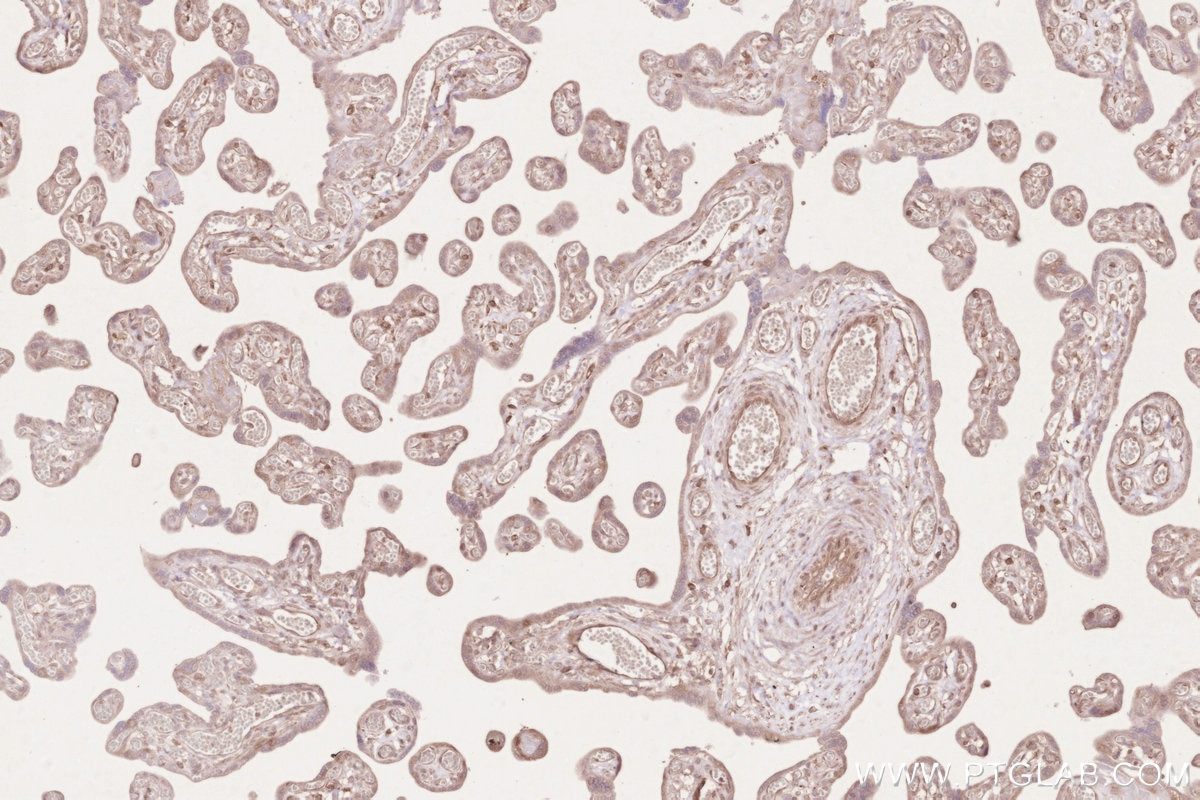 IHC staining of human placenta using 16820-1-AP Immunohistochemistry (IHC) staining of human placenta tissue using ZC3HAV1 Polyclonal antibody (16820-1-AP)