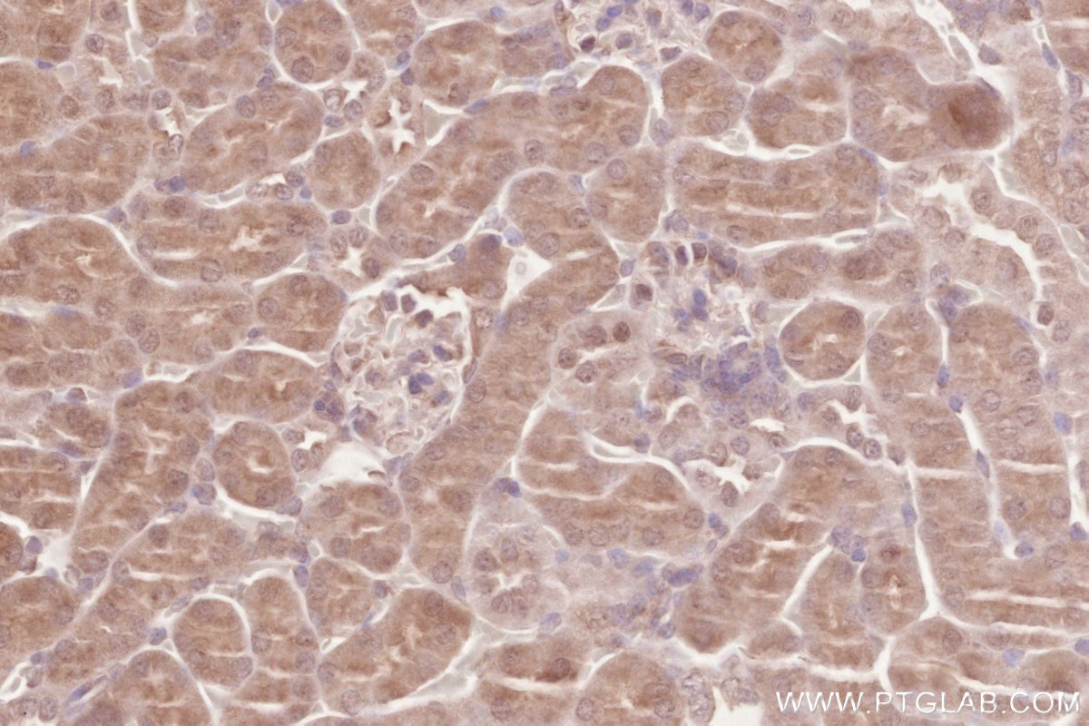 IHC staining of mouse kidney using 16820-1-AP Immunohistochemistry (IHC) staining of mouse kidney tissue using ZC3HAV1 Polyclonal antibody (16820-1-AP)