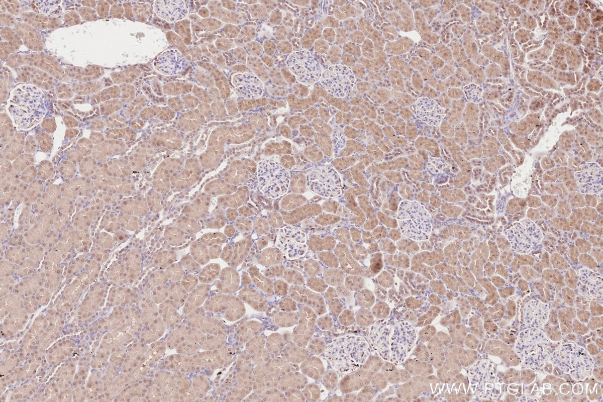 IHC staining of rat kidney using 16820-1-AP Immunohistochemistry (IHC) staining of rat kidney tissue using ZC3HAV1 Polyclonal antibody (16820-1-AP)