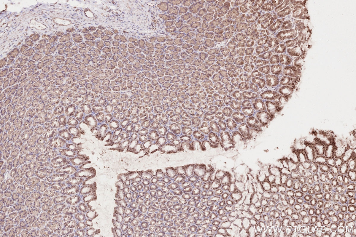 IHC staining of rat stomach using 16820-1-AP Immunohistochemistry (IHC) staining of rat stomach tissue using ZC3HAV1 Polyclonal antibody (16820-1-AP)