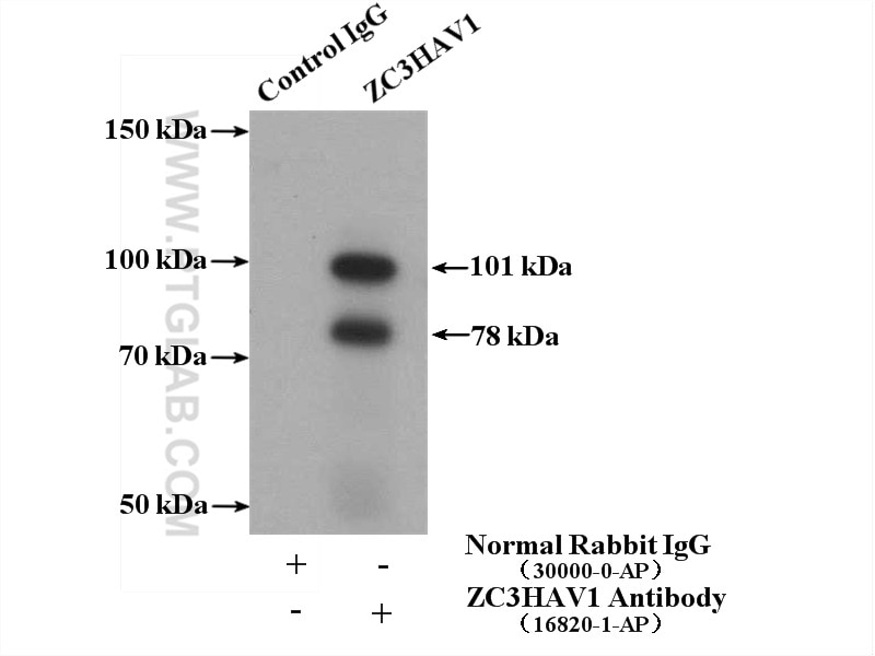 Immunoprecipitation (IP) experiment of HeLa cells using ZC3HAV1 Polyclonal antibody (16820-1-AP)