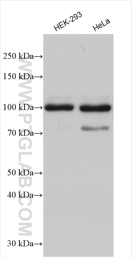 Western Blot (WB) analysis of various lysates using ZC3HAV1 Polyclonal antibody (16820-1-AP)
