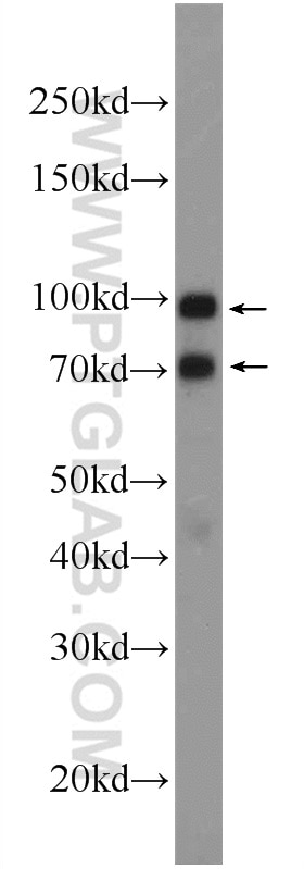 Western Blot (WB) analysis of HeLa cells using ZC3HAV1 Polyclonal antibody (16820-1-AP)