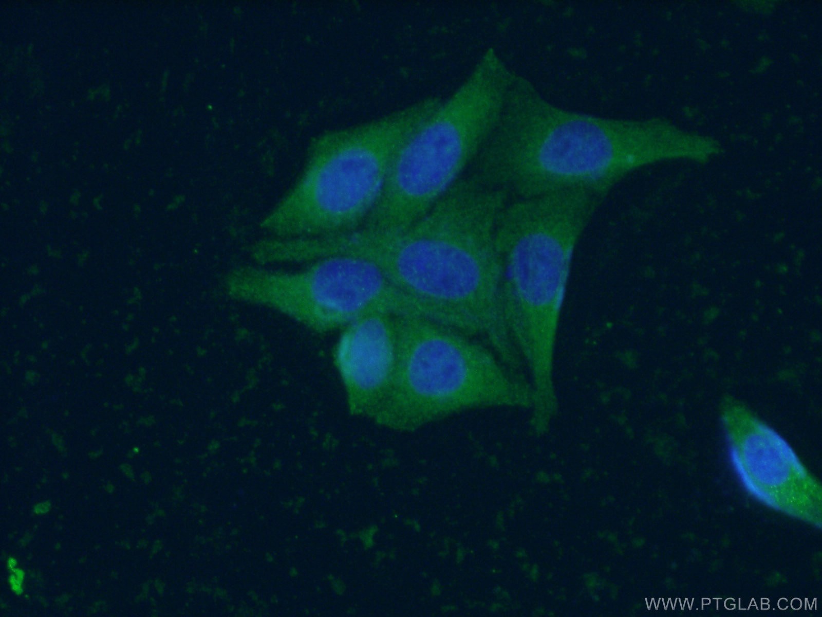 Immunofluorescence (IF) / fluorescent staining of HepG2 cells using ZC3HAV1 Monoclonal antibody (66413-1-Ig)