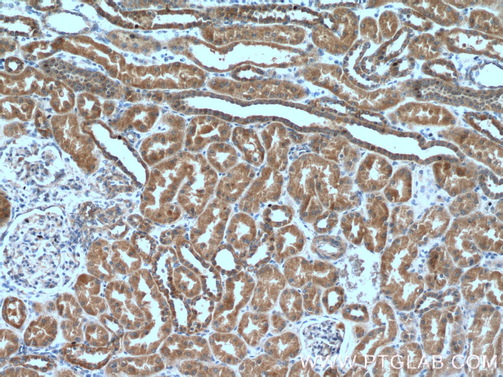 Immunohistochemistry (IHC) staining of human kidney tissue using ZC3HAV1 Monoclonal antibody (66413-1-Ig)