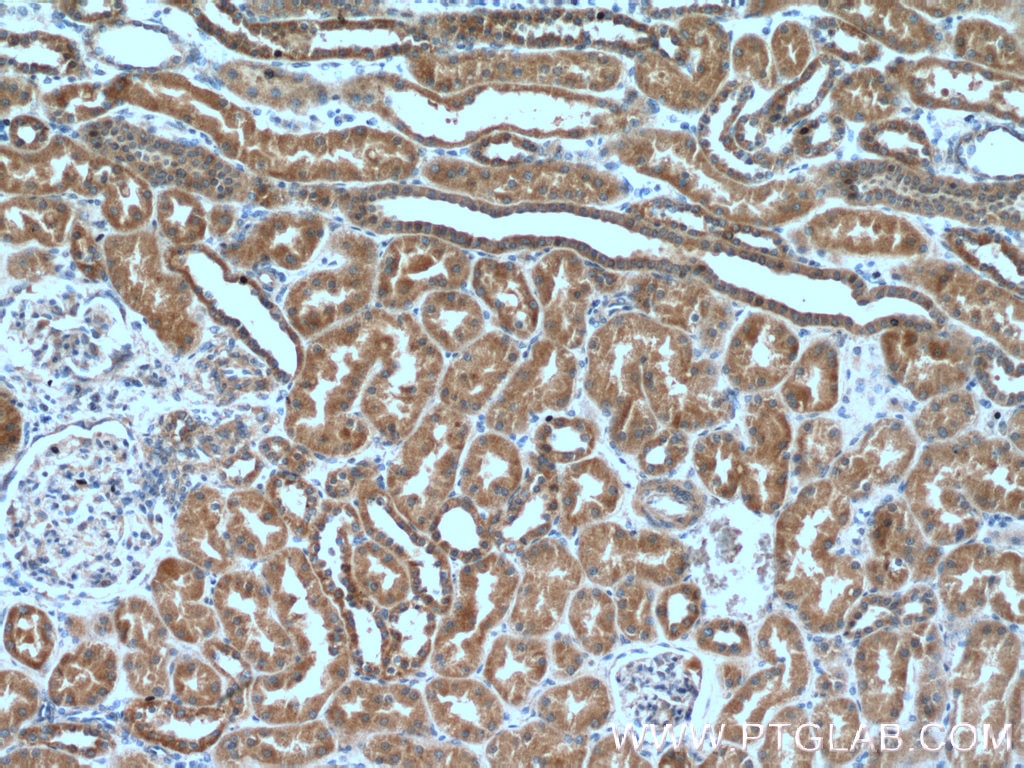 IHC staining of human kidney using 66413-1-Ig