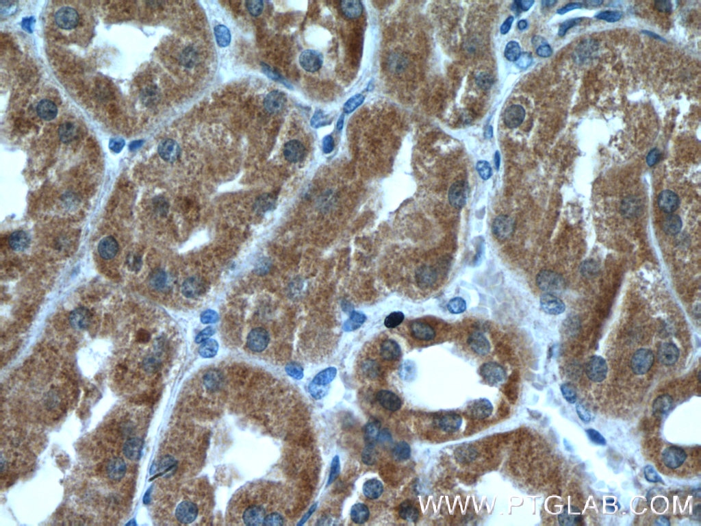 Immunohistochemistry (IHC) staining of human kidney tissue using ZC3HAV1 Monoclonal antibody (66413-1-Ig)