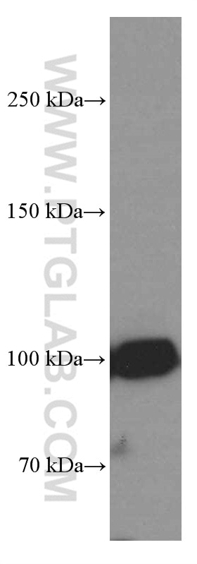 Western Blot (WB) analysis of HEK-293 cells using ZC3HAV1 Monoclonal antibody (66413-1-Ig)