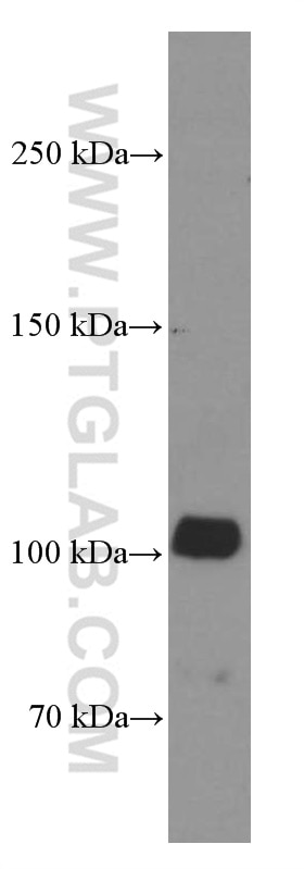 Western Blot (WB) analysis of Jurkat cells using ZC3HAV1 Monoclonal antibody (66413-1-Ig)