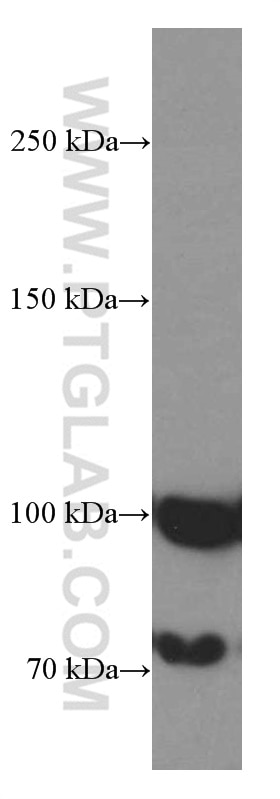 Western Blot (WB) analysis of HeLa cells using ZC3HAV1 Monoclonal antibody (66413-1-Ig)