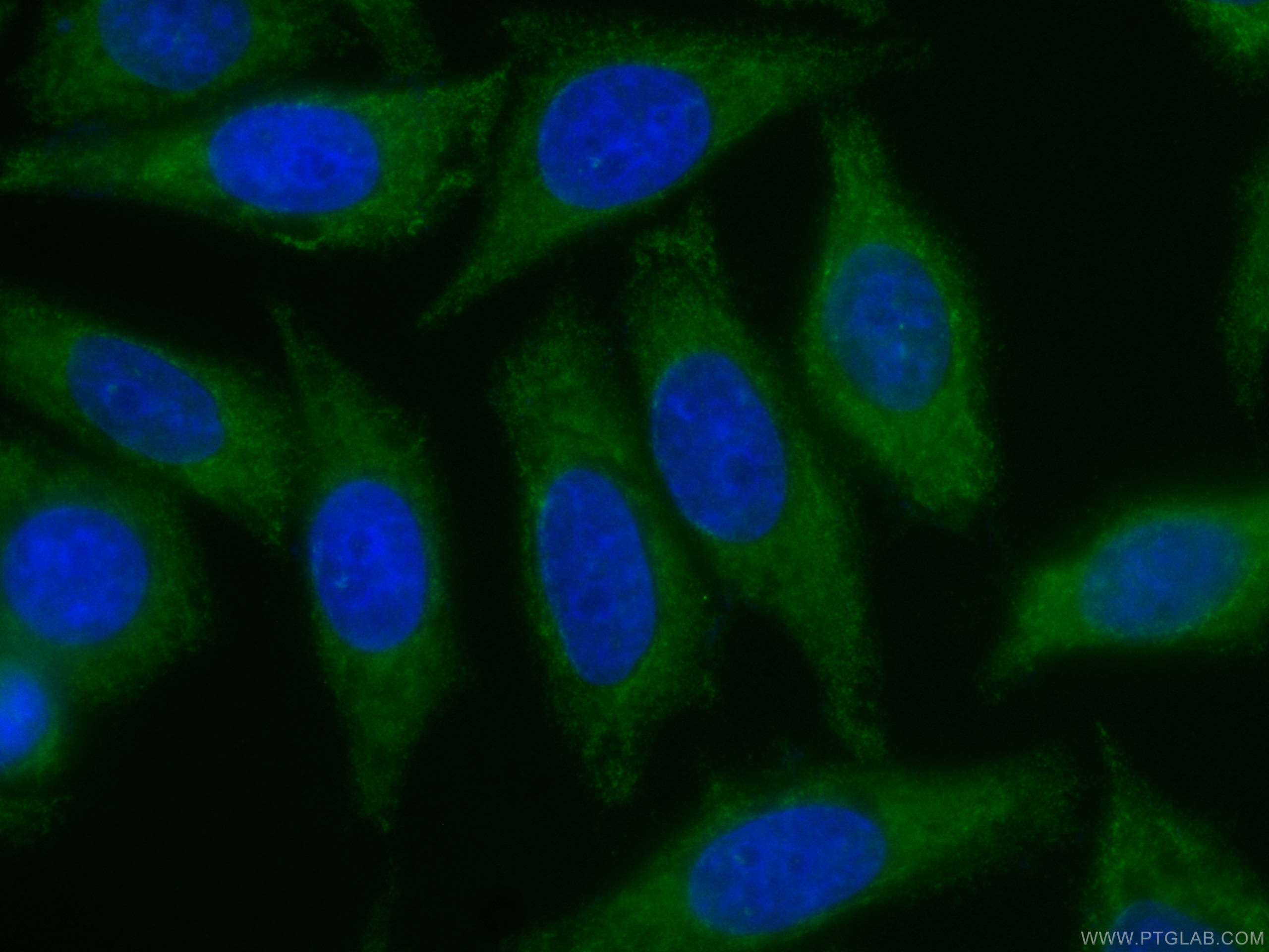 Immunofluorescence (IF) / fluorescent staining of HepG2 cells using CoraLite®488-conjugated ZC3HAV1 Monoclonal antibod (CL488-66413)