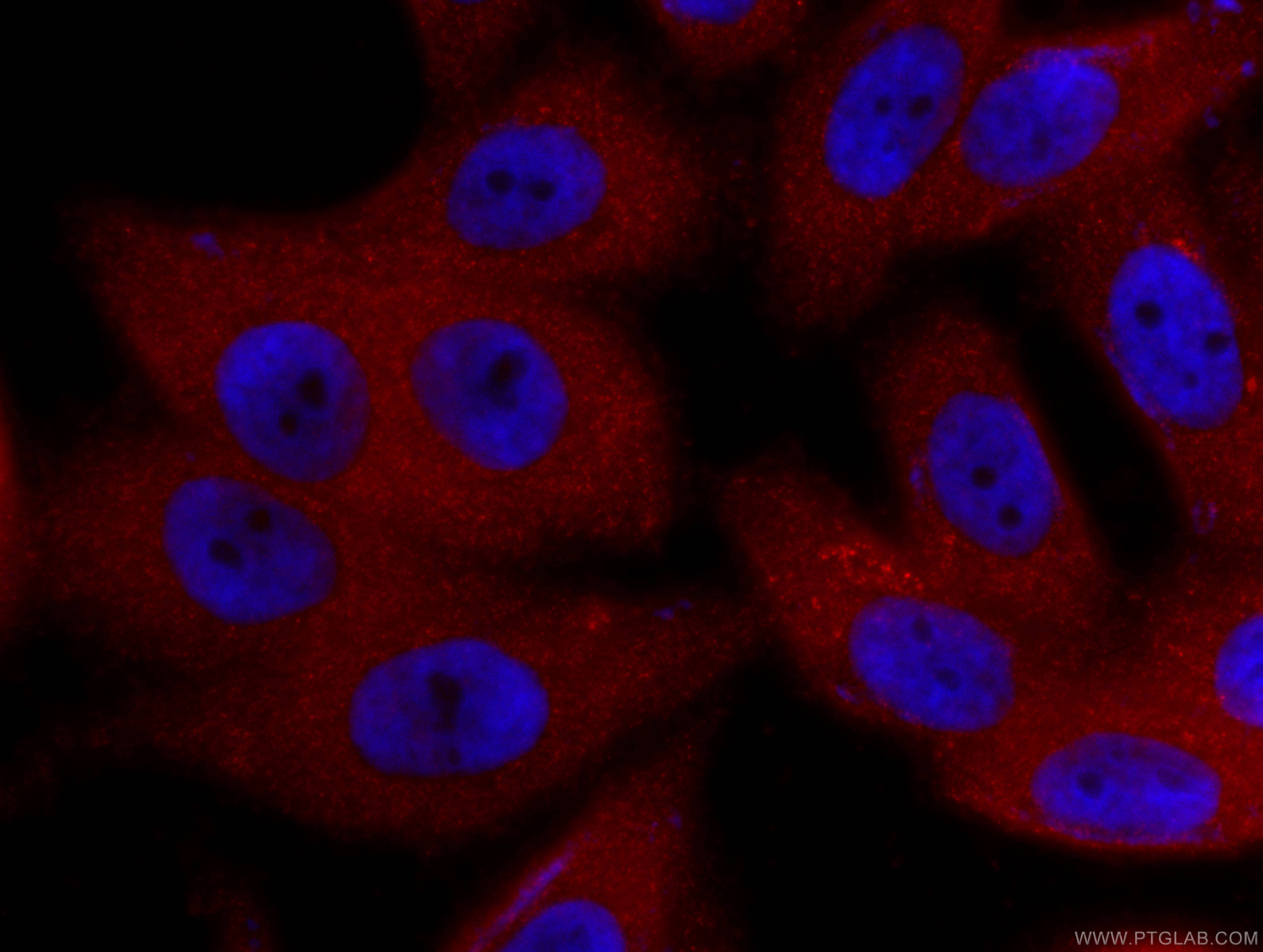 Immunofluorescence (IF) / fluorescent staining of HepG2 cells using CoraLite®594-conjugated ZC3HAV1 Monoclonal antibod (CL594-66413)