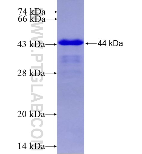 ZC3HAV1 fusion protein Ag10364 SDS-PAGE