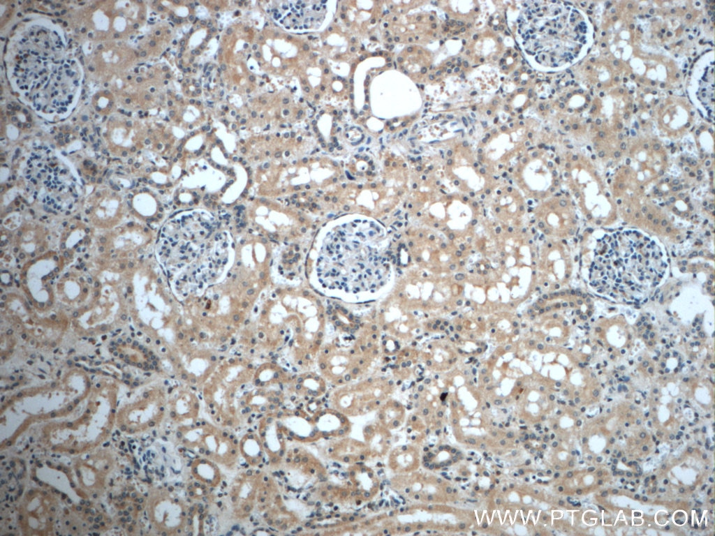 Immunohistochemistry (IHC) staining of human kidney tissue using ZC3HAV1L Polyclonal antibody (20944-1-AP)