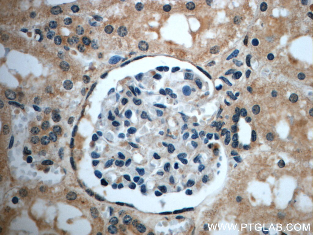 Immunohistochemistry (IHC) staining of human kidney tissue using ZC3HAV1L Polyclonal antibody (20944-1-AP)