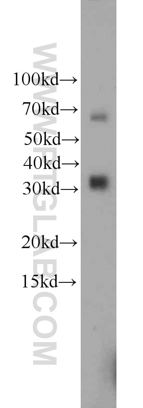 Western Blot (WB) analysis of HepG2 cells using ZC3HAV1L Polyclonal antibody (20944-1-AP)