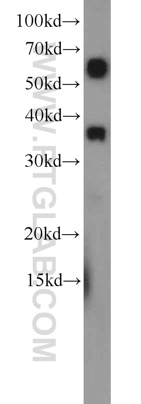 Western Blot (WB) analysis of SW 1990 cells using ZC3HAV1L Polyclonal antibody (20944-1-AP)