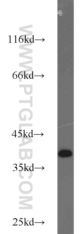 Western Blot (WB) analysis of Jurkat cells using ZC3HAV1L Polyclonal antibody (20944-1-AP)