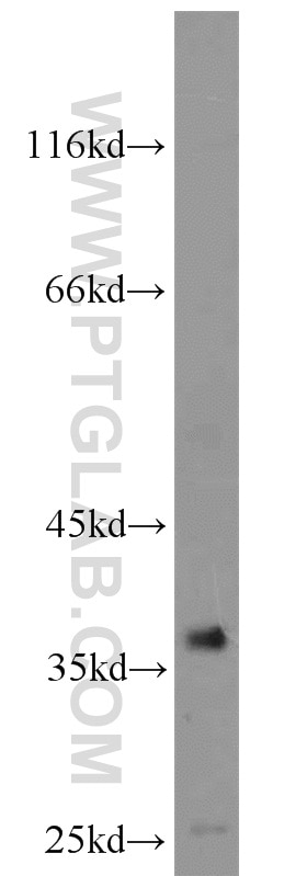 WB analysis of HeLa using 20944-1-AP