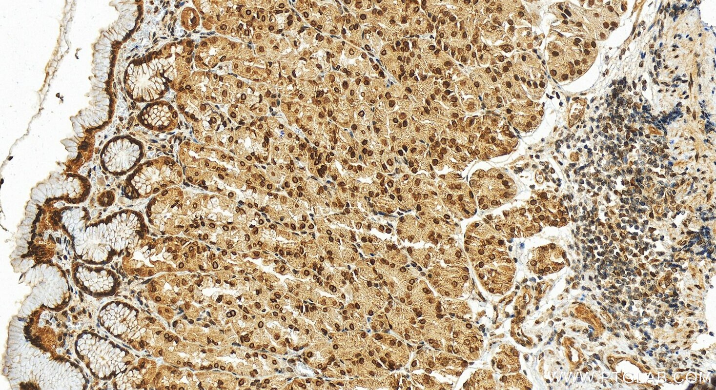 Immunohistochemistry (IHC) staining of human stomach tissue using ZC3HC1 Polyclonal antibody (13148-1-AP)