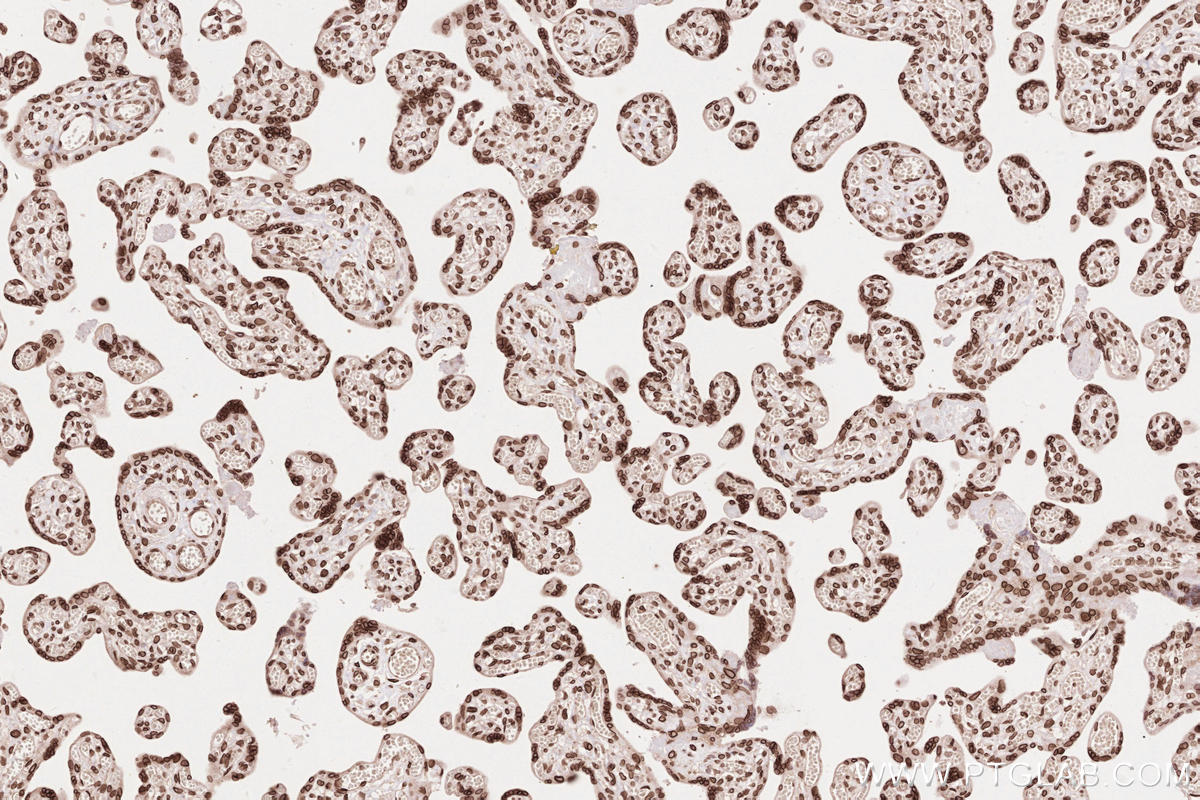 IHC staining of human placenta using 13148-1-AP Immunohistochemistry (IHC) staining of human placenta tissue using ZC3HC1 Polyclonal antibody (13148-1-AP)