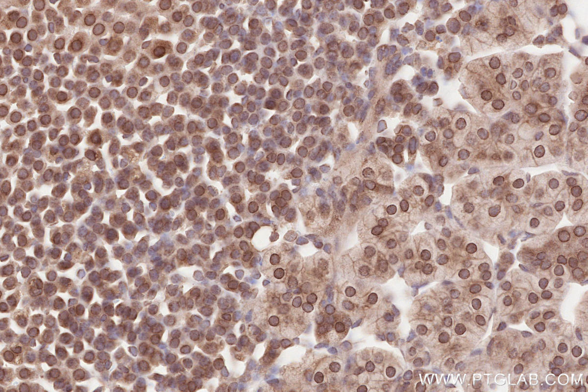IHC staining of mouse adrenal gland using 13148-1-AP Immunohistochemistry (IHC) staining of mouse adrenal gland tissue using ZC3HC1 Polyclonal antibody (13148-1-AP)