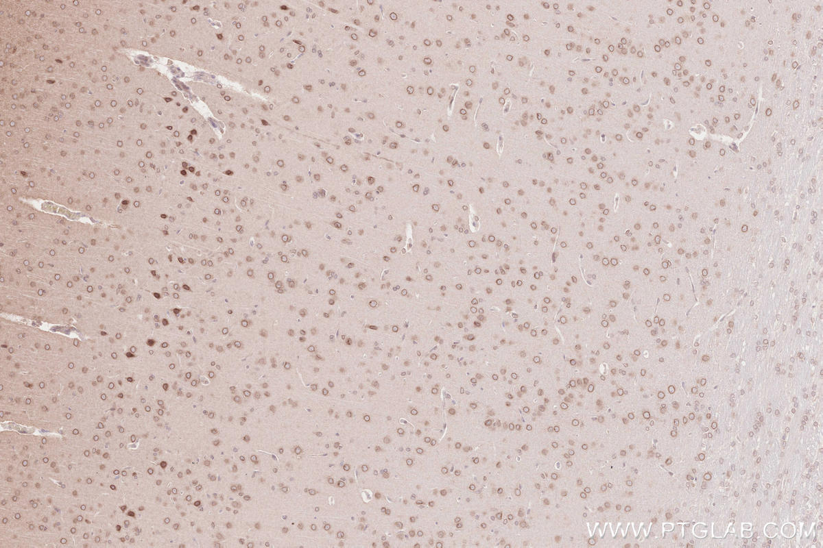 IHC staining of rat brain using 13148-1-AP Immunohistochemistry (IHC) staining of rat brain tissue using ZC3HC1 Polyclonal antibody (13148-1-AP)