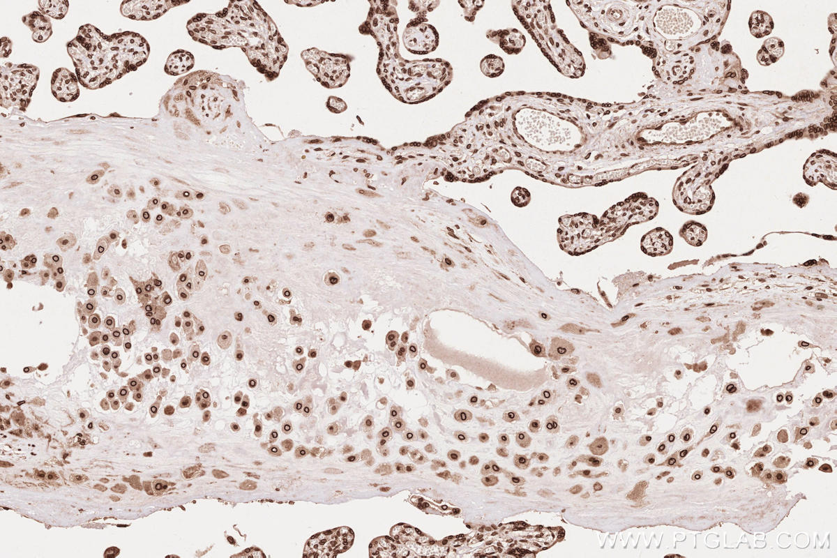 IHC staining of human placenta using 13148-1-AP Immunohistochemistry (IHC) staining of human placenta tissue using ZC3HC1 Polyclonal antibody (13148-1-AP)