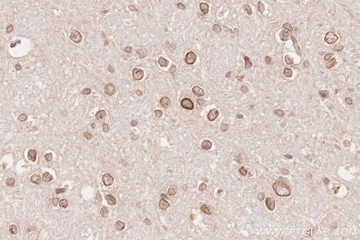 IHC staining of mouse cerebellum using 13148-1-AP Immunohistochemistry (IHC) staining of mouse cerebellum tissue using ZC3HC1 Polyclonal antibody (13148-1-AP)