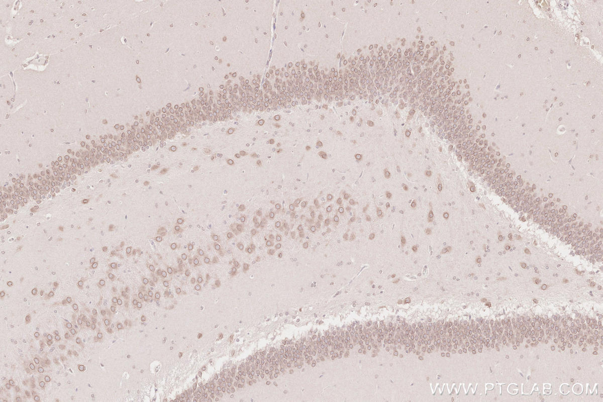 IHC staining of rat brain using 13148-1-AP Immunohistochemistry (IHC) staining of rat brain tissue using ZC3HC1 Polyclonal antibody (13148-1-AP)