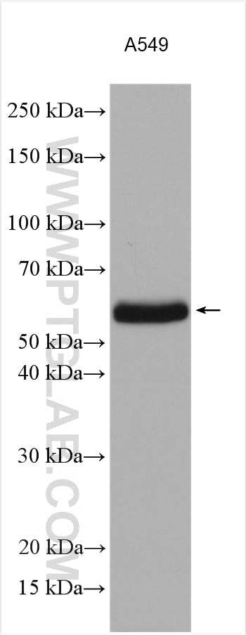 Western Blot (WB) analysis of various lysates using ZC3HC1 Polyclonal antibody (13148-1-AP)
