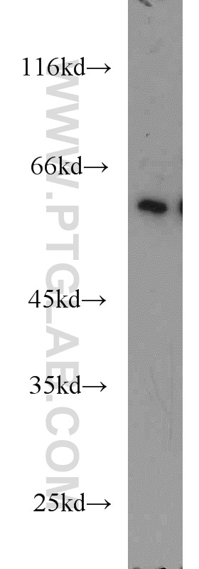 Western Blot (WB) analysis of mouse skeletal muscle tissue using ZC3HC1 Polyclonal antibody (13148-1-AP)