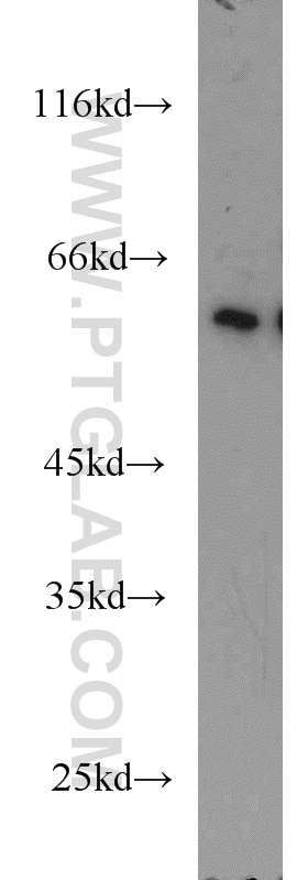 WB analysis of mouse skeletal muscle using 13148-1-AP