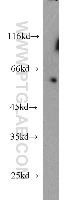 Western Blot (WB) analysis of mouse heart tissue using ZC3HC1 Polyclonal antibody (13148-1-AP)