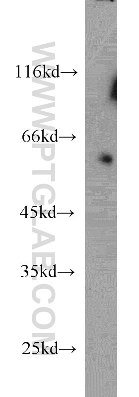 WB analysis of mouse heart using 13148-1-AP