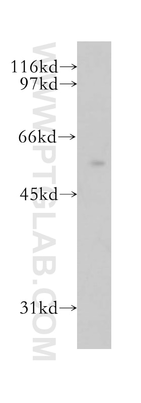 Western Blot (WB) analysis of mouse lung tissue using ZC3HC1 Polyclonal antibody (13148-1-AP)