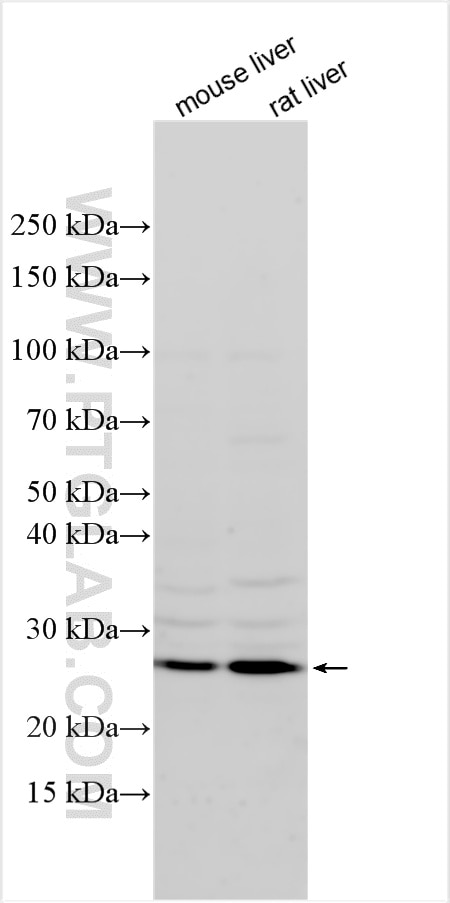 Western Blot (WB) analysis of various lysates using ZC4H2 Polyclonal antibody (20526-1-AP)