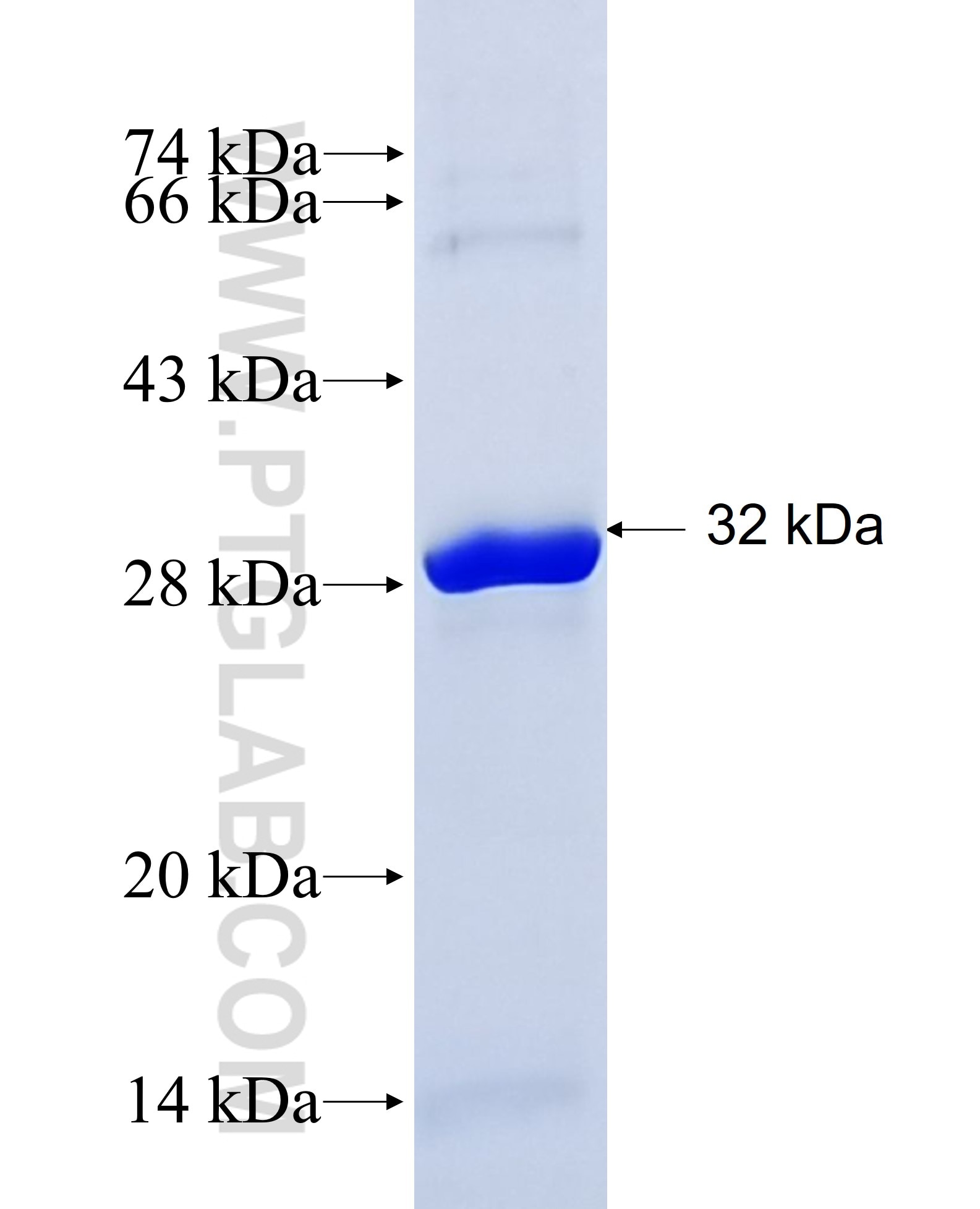 ZC4H2 fusion protein Ag14995 SDS-PAGE