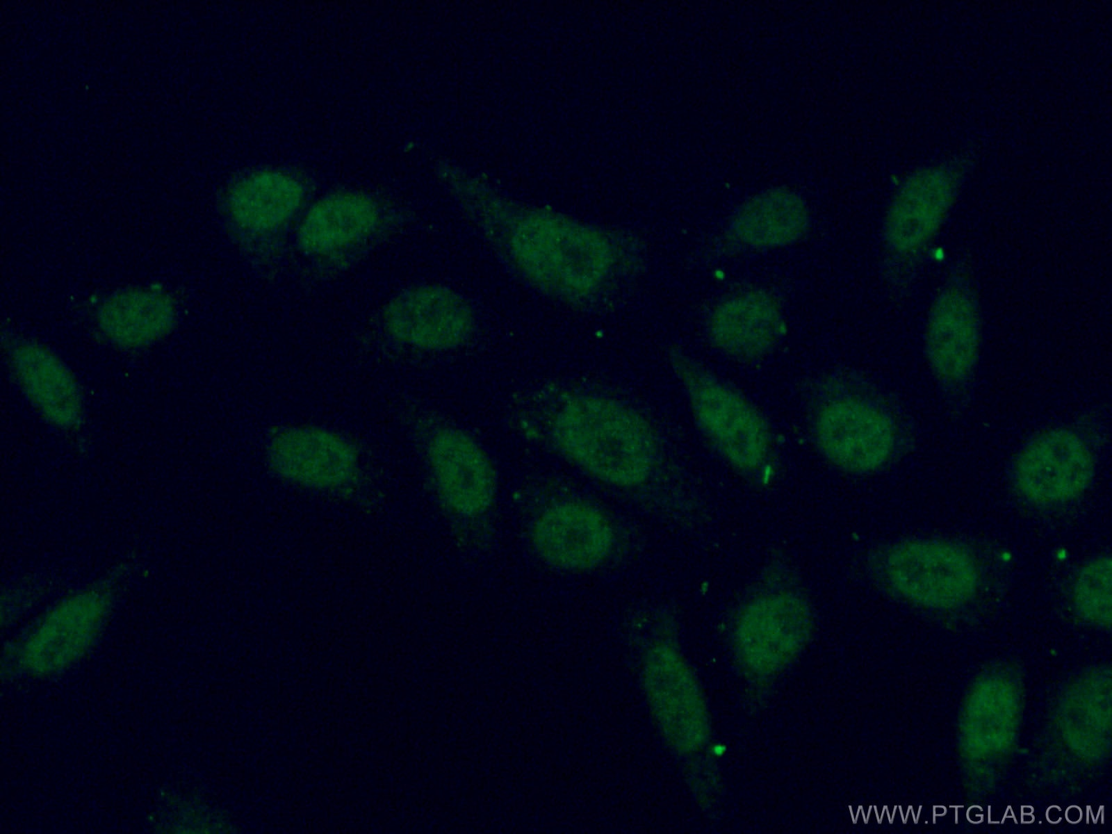 Immunofluorescence (IF) / fluorescent staining of HepG2 cells using ZCCHC11 Polyclonal antibody (18980-1-AP)
