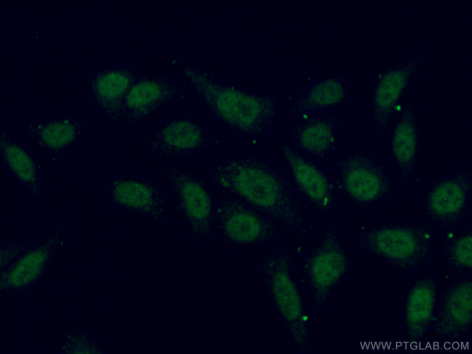 IF Staining of HepG2 using 18980-1-AP