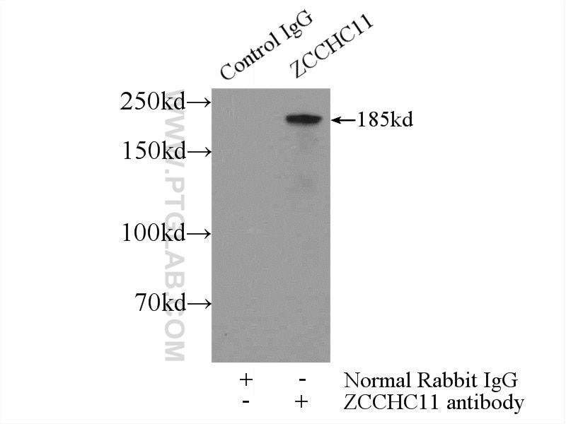 Immunoprecipitation (IP) experiment of MCF-7 cells using ZCCHC11 Polyclonal antibody (18980-1-AP)