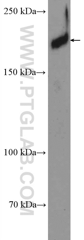 Western Blot (WB) analysis of HEK-293T cells using ZCCHC11 Polyclonal antibody (18980-1-AP)