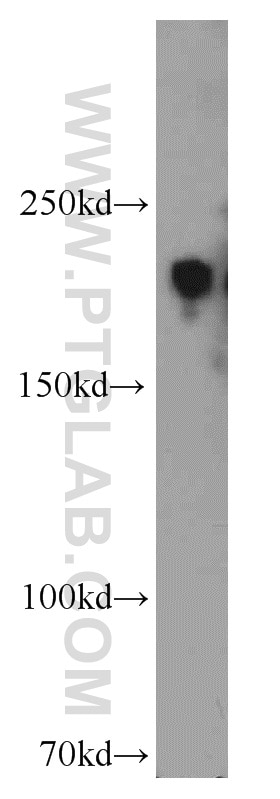 Western Blot (WB) analysis of HeLa cells using ZCCHC11 Polyclonal antibody (18980-1-AP)