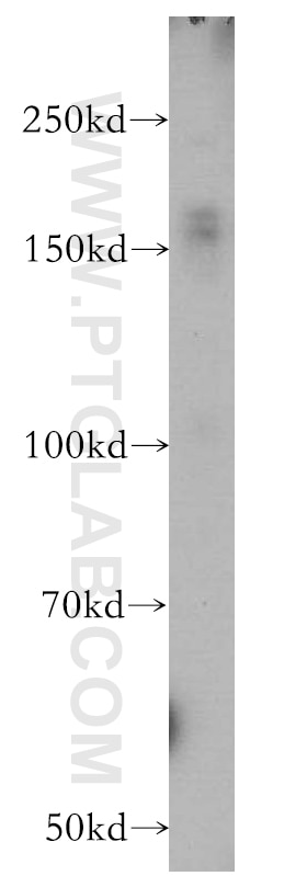 Western Blot (WB) analysis of human brain tissue using ZCCHC11 Polyclonal antibody (18980-1-AP)